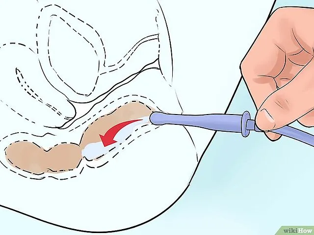 wikiHow — No specific person’s name has been provided. on Wikimedia Commons 