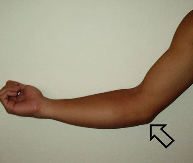 Hipnotic88 on Wikimedia Commons