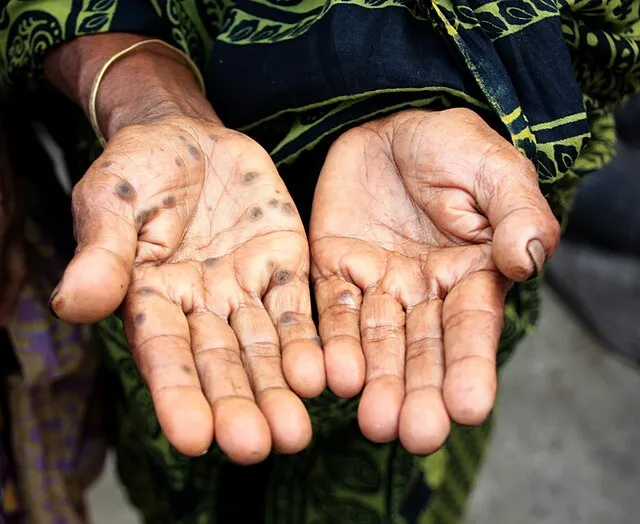 Anita Ghosh/REACH on Wikimedia Commons