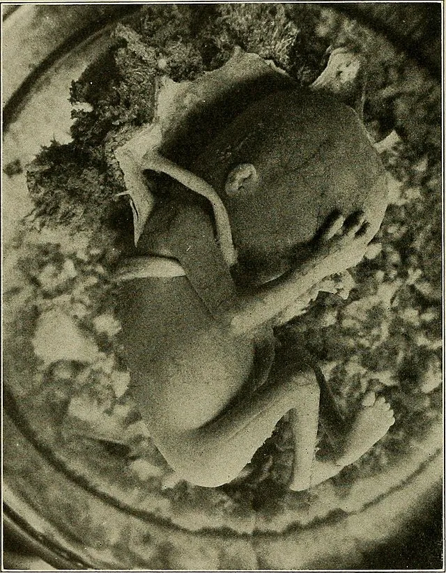 Internet Archive Book Images on Wikimedia Commons 