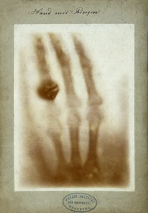 Image from Wikipedia