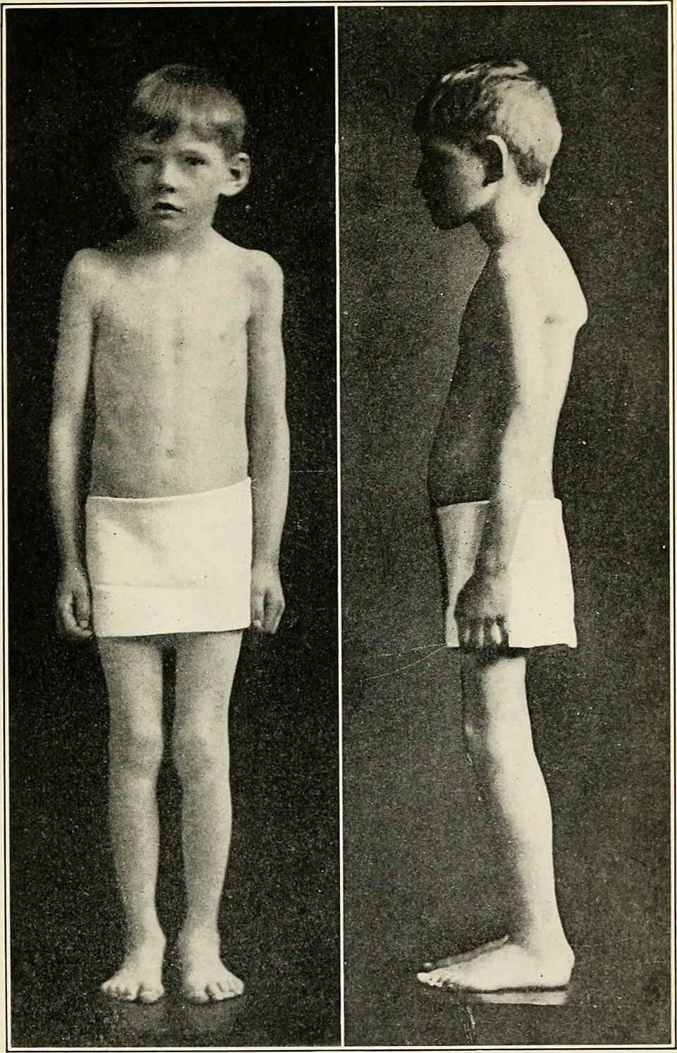 Internet Archive Book Images on Wikicommons