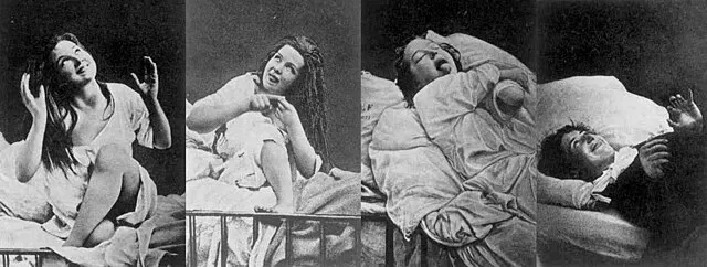 D.M. Bourneville and P. Régnard on Wikimedia