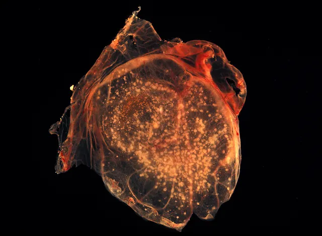 CDC/Dr. David Kirsh on Wikimedia Commons