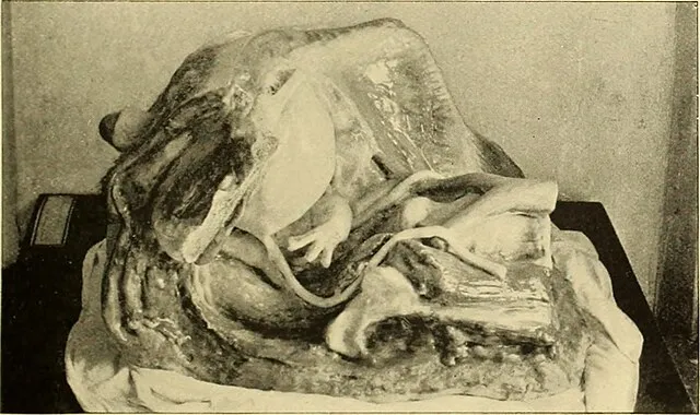 Internet Archive Book Images on Wikicommons