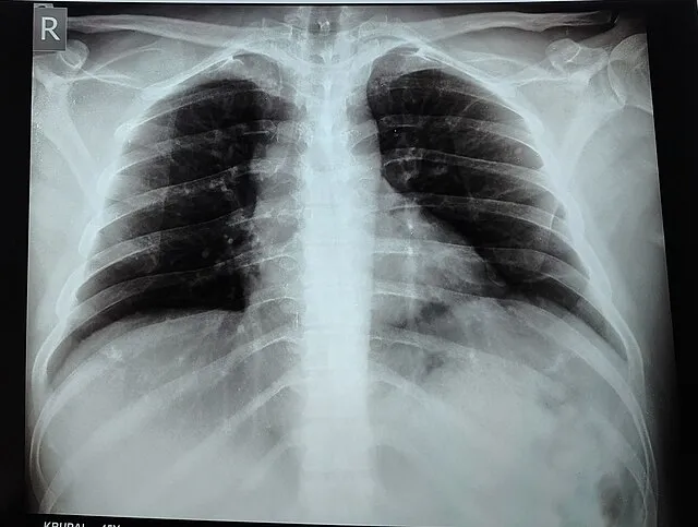 Wikibantu on wikimedia