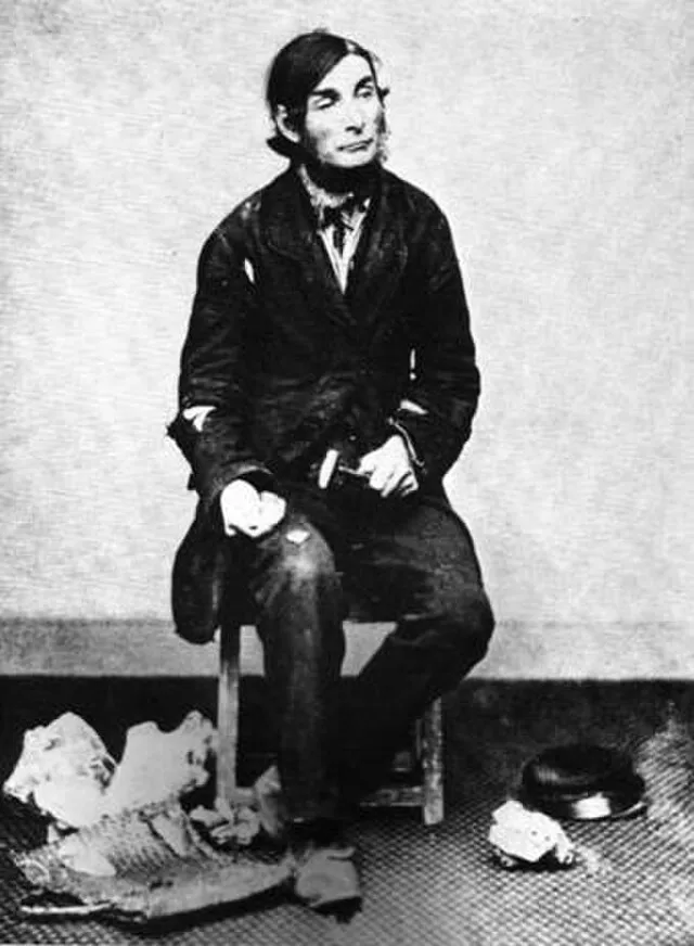 Unknown author on Wikimedia Commons
