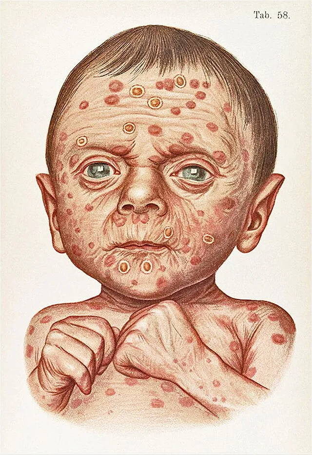 Mraček F on wikimedia