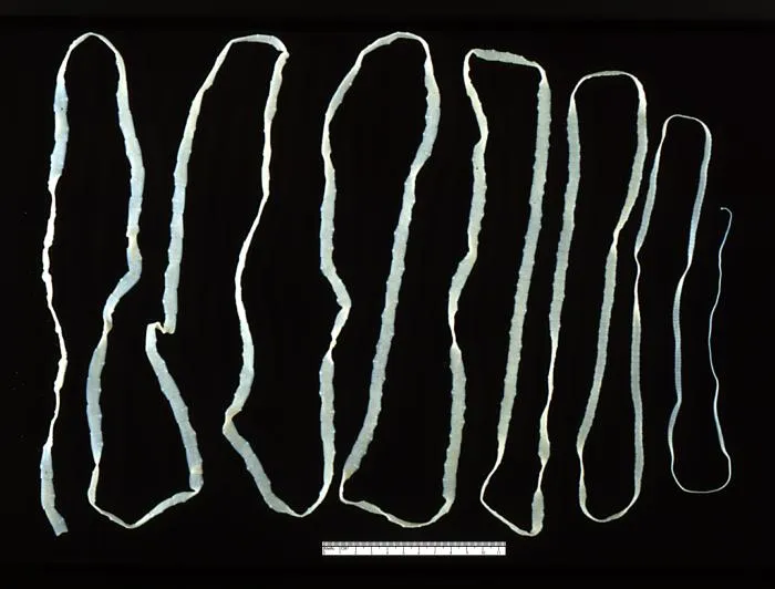 Image from Wikipedia
