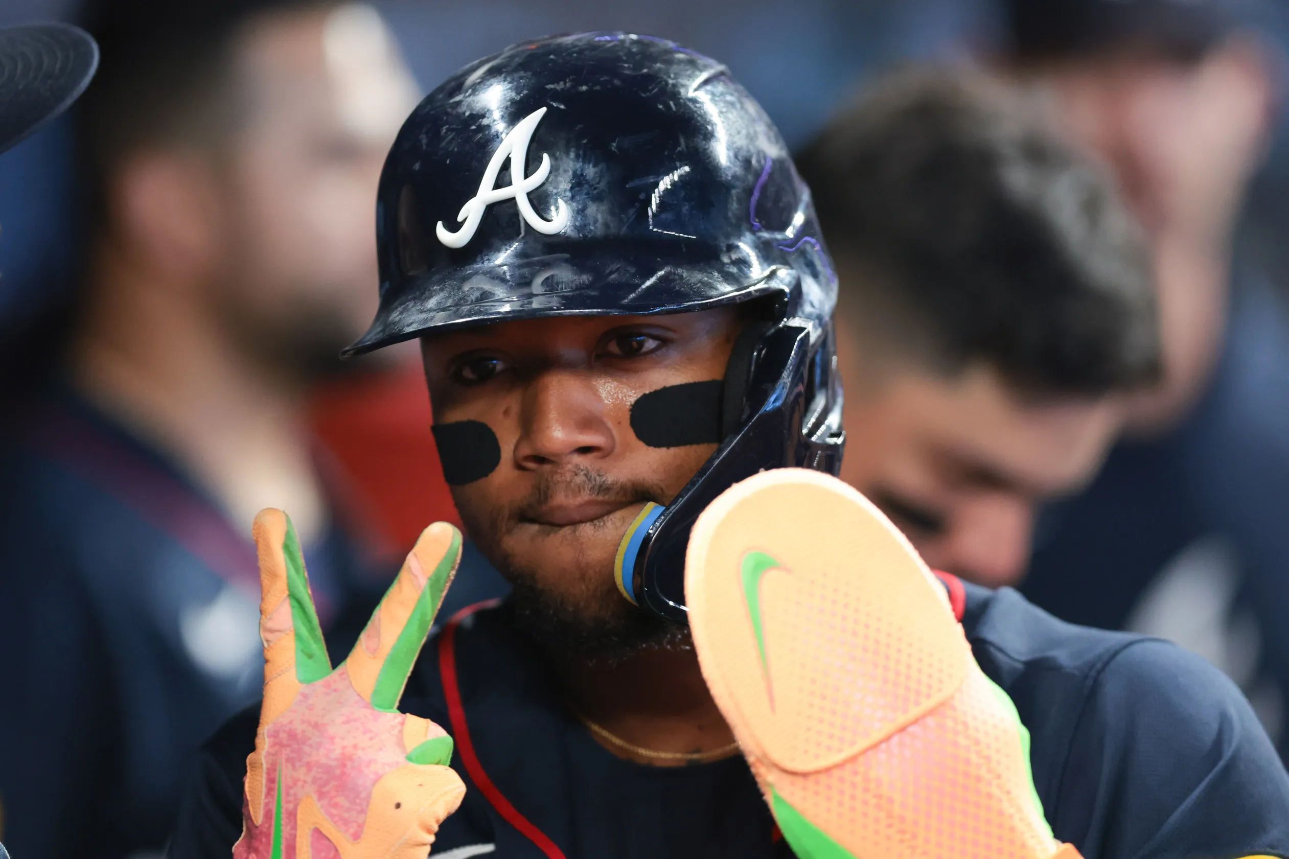 Ronald Acuña Jr. Day-to-Day After Thumb Scare as Braves Avoid Serious Injury Concern