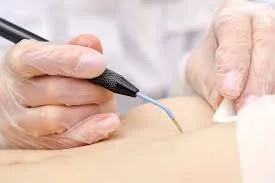 Image from Op. Dr. Engin Sarıca