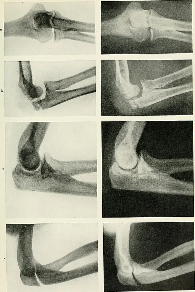 Knox, Robert on Wikimedia Commons